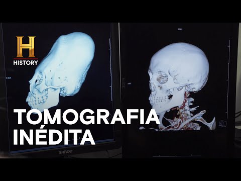 Leia mais sobre o artigo Suturas cranianas jamais vistas nos seres humanos | ALIENÍGENAS DO PASSADO | HISTORY